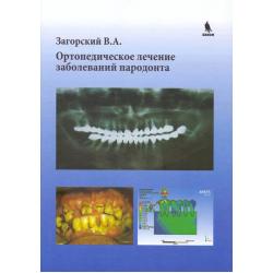 Ортопедическое лечение заболеваний пародонта