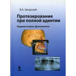 Протезирование при полной адентии