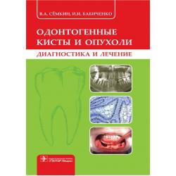 Одонтогенные кисты и опухоли. Диагностика и лечение