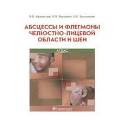 Абсцессы и флегмоны челюстно-лицевой области и шеи. Атлас