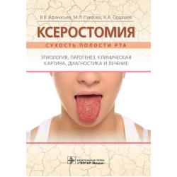 Ксеростомия (сухость полости рта). Этиология, патогенез, клиническая картина, диагностика и лечение