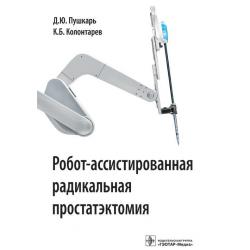 Робот-ассистированная радикальная простатэктомия