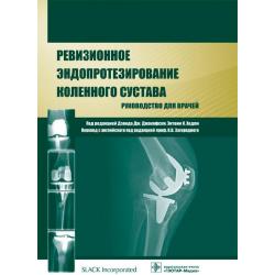 Ревизионное эндопротезирование коленного сустава. Руководство для врачей