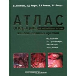 Атлас операций при злокачественных опухолях женских половых органов. Научно-практическое издание