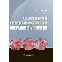 Лапароскопические и ретроперитонеоскопические операции в урологии / Кадыров Зиератшо Абдуллоевич