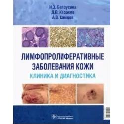 Лимфопролиферативные заболеванания кожи. Клиника и диагностика